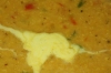 Masoor Dal