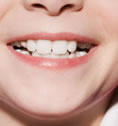 人工手段让牙齿恢复美白